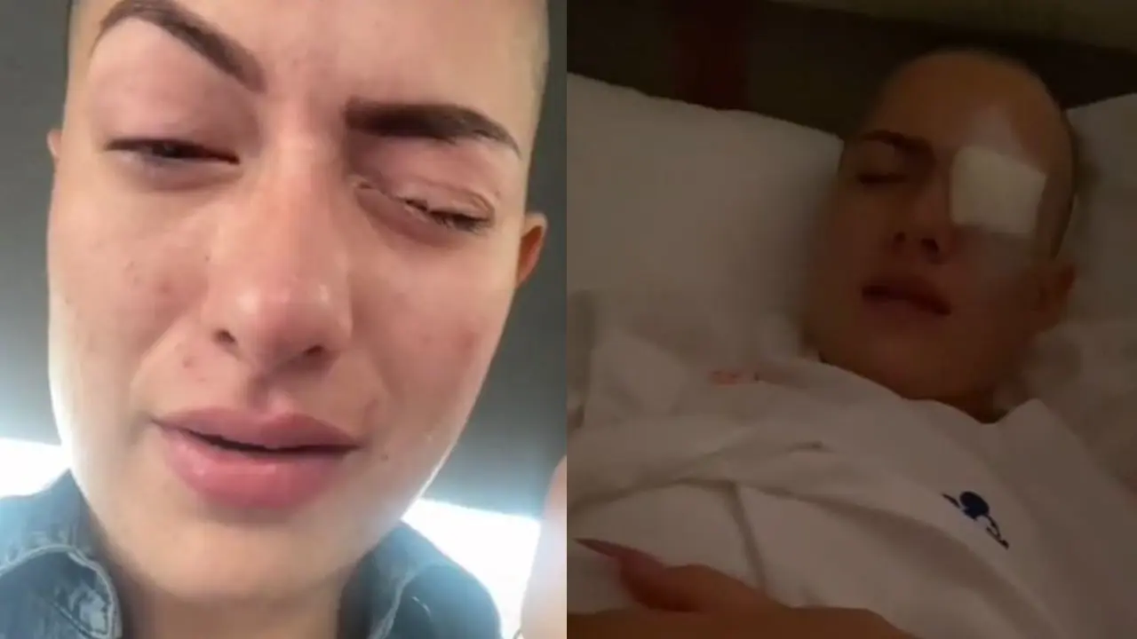 Influencer se echa kola loka en el ojo y termina con la córnea dañada. Foto: captura de pantalla.