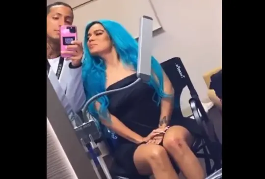VIDEO: Karol G muestra los moretones que sufrió por caída en concierto VIDEO: Karol G muestra los moretones que sufrió por caída en concierto