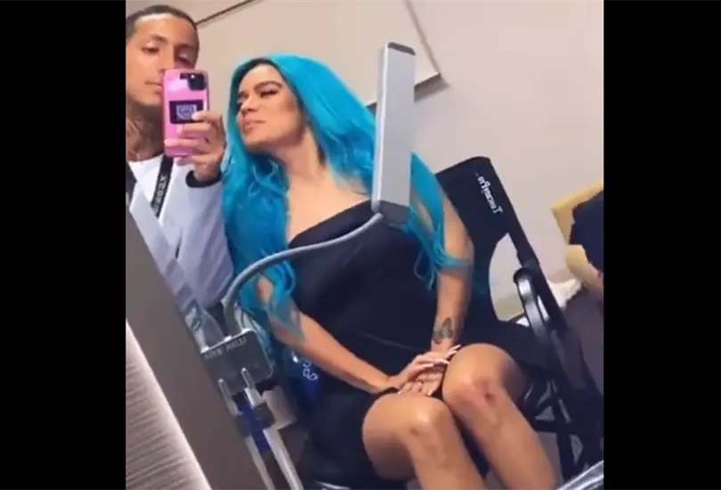VIDEO: Karol G muestra los moretones que sufrió por caída en concierto VIDEO: Karol G muestra los moretones que sufrió por caída en concierto