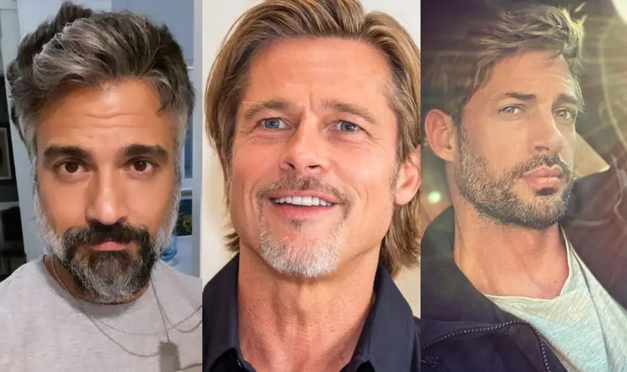 Hombres famosos que se han hecho cirug&iacute;a pl&aacute;stica