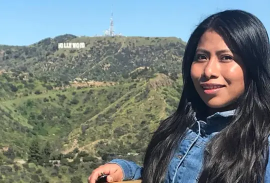 Yalitza Aparicio revela que tiene enfermedad en la piel de su rostro