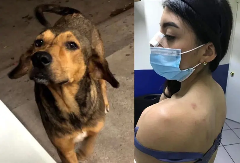 #JusticiaParaRodolfo: Novia del posible asesino afirma que el perro la agredió #JusticiaParaRodolfo: Novia del posible asesino afirma que el perro la agredió