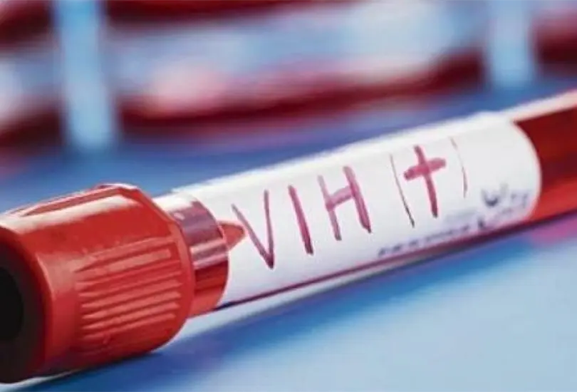 Probar&aacute;n fase 3 de vacuna contra VIH en la CDMX