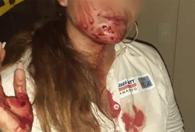 Adulto mayor golpea en la cara con un bast&oacute;n a candidata de SLP