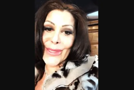 Las celebridades que abusaron del botox Las celebridades que abusaron del botox