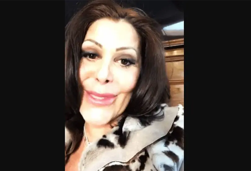 Las celebridades que abusaron del botox
