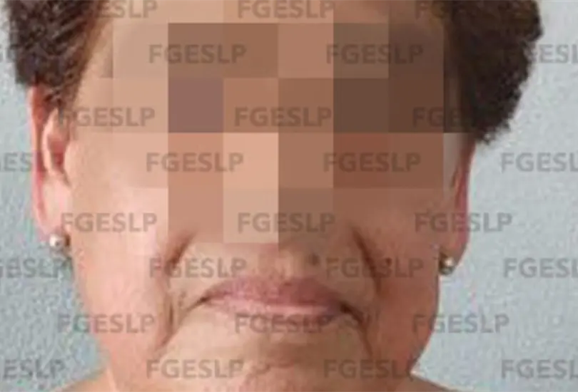 Mujer de 60 a&ntilde;os asesina a su esposo a pu&ntilde;aladas en SLP