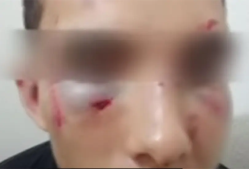 Primo de Remmy Valenzuela revela su verdad tras golpiza del cantante