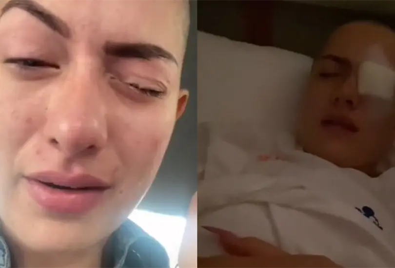 Influencer se echa kola loka en el ojo y termina con la córnea dañada Influencer se echa kola loka en el ojo y termina con la córnea dañada