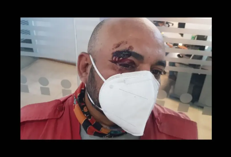 Comerciantes ambulantes agreden a periodistas en Puebla
