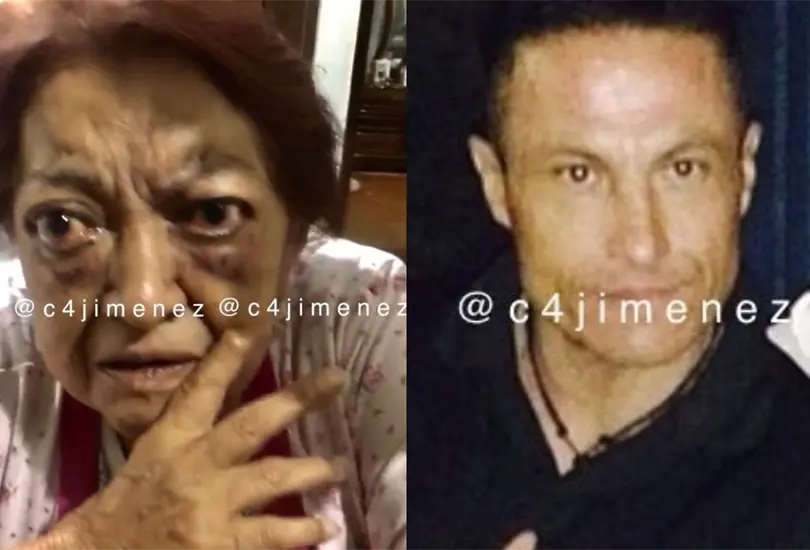 Se&ntilde;ora de 85 a&ntilde;os es golpeada por su propio hijo; Fiscal&iacute;a ya lo investiga 