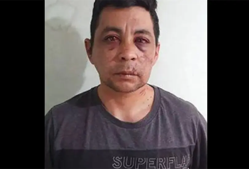 Muere enfermero atacado por sus vecinos al enterarse que ten&iacute;a COVID-19