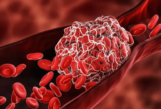 Trombosis, vacuna y COVID-19: cuáles son los riesgos de desarrollar coágulos