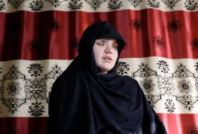 Los talibanes alimentan a sus perros con cuerpos de mujeres, revela una sobreviviente