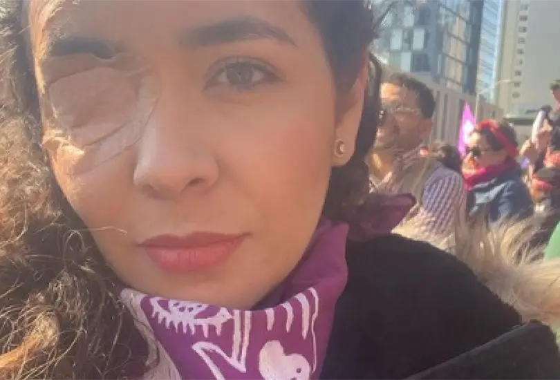 Tienes que cruzar el infierno para tener justicia: Ana Salda&ntilde;a busca a la mujer que la atac&oacute; con &aacute;cido en 2018 