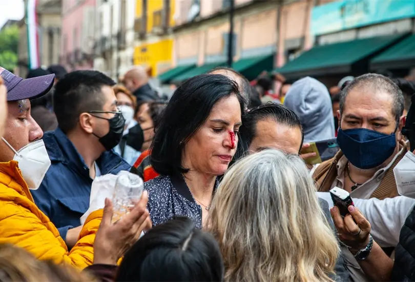 Alcaldesa electa en la CDMX acusa a polic&iacute;as granaderos de romperle la nariz 
