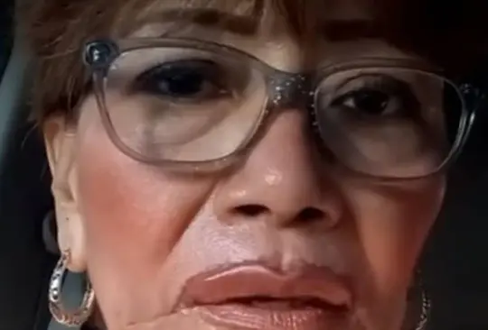 Mujer hace broma a su hija y se pega los labios con Kola Loka Mujer hace broma a su hija y se pega los labios con Kola Loka