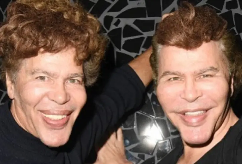 Gemelos Bogdanoff fallecen por COVID con seis días de diferencia; no se vacunaron Gemelos Bogdanoff fallecen por COVID con seis días de diferencia; no se vacunaron