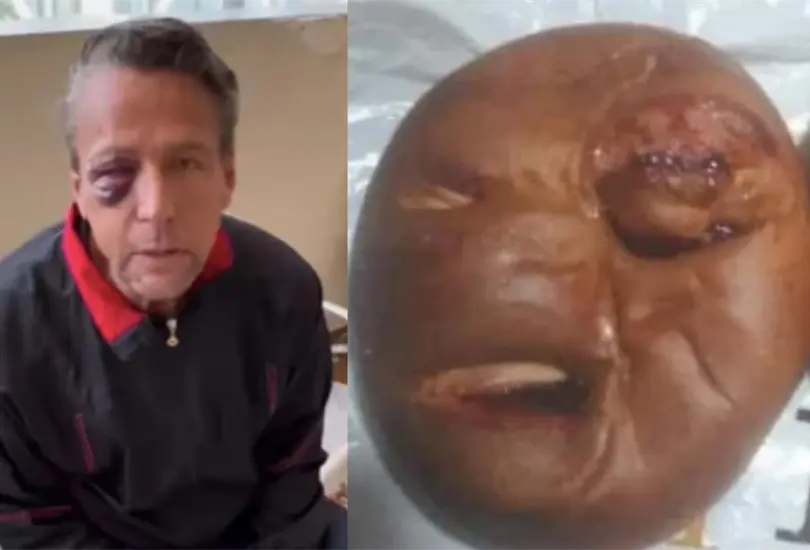 El actor de telenovelas intentó ayudar a las víctimas de un ataque directo cerca de su hogar, pero fue agredido al cercarse Créditos: Especial El actor de telenovelas intentó ayudar a las víctimas de un ataque directo cerca de su hogar, pero fue agredido al cercarse Créditos: Especial