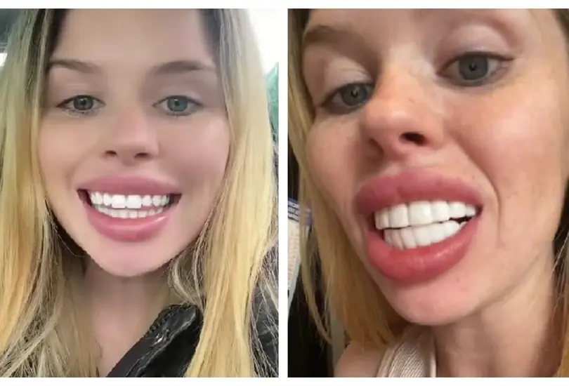 Joven se queja de su dise&ntilde;o de sonrisa 