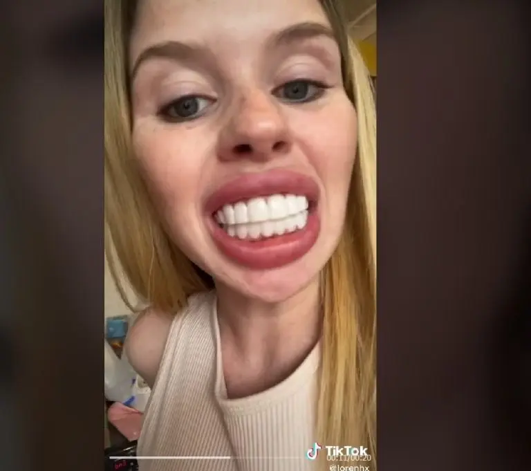 Joven se queja de su diseño de sonrisa (TikTok)
