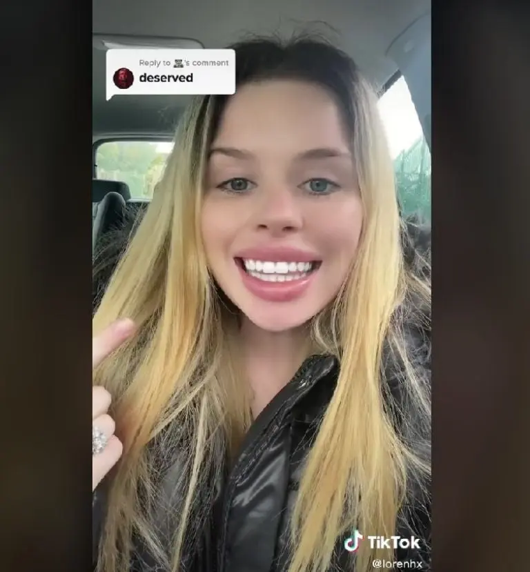 Joven se queja de su diseño de sonrisa (TikTok)