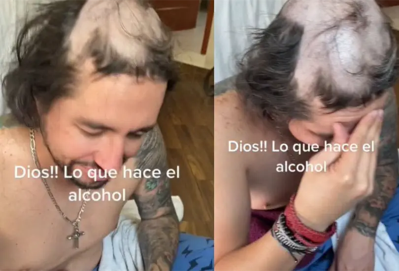 Los ni&ntilde;os raparon a sus pap&aacute; mientras &eacute;ste dorm&iacute;a luego de haberse tomado unas cervezas