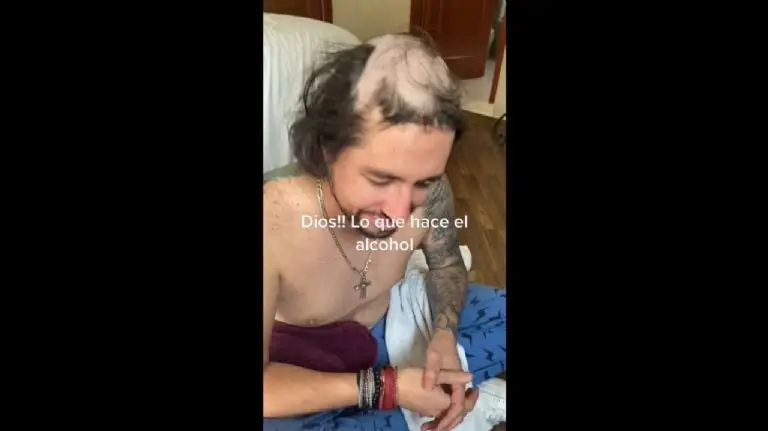 Sus hijos lo raparon mientras dormía - Tomada de video