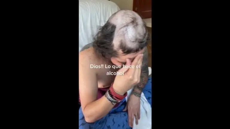 El hombre despertó sin cabello - Tomada de video