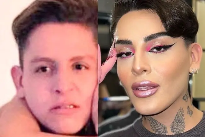 El influencer es uno de los más populares del medio digital, y a lo largo de su vida se ha sometido a varias cirugías. Te mostramos cómo ha sido el cambio físico de Kunno.