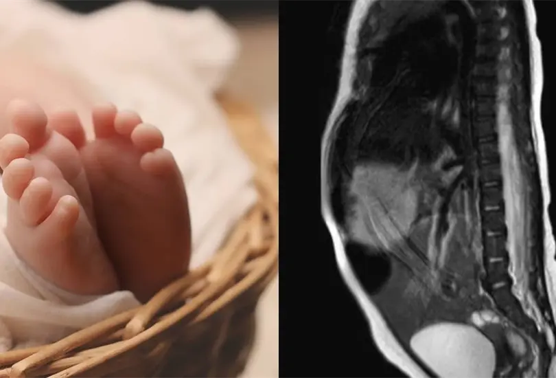 La extremidad sobresal&iacute;a al final de su coxis Cr&eacute;ditos: Especial