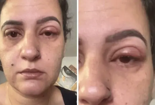 Afortunadamente, la mujer no tuvo problemas con su visión Créditos: Especial Afortunadamente, la mujer no tuvo problemas con su visión Créditos: Especial