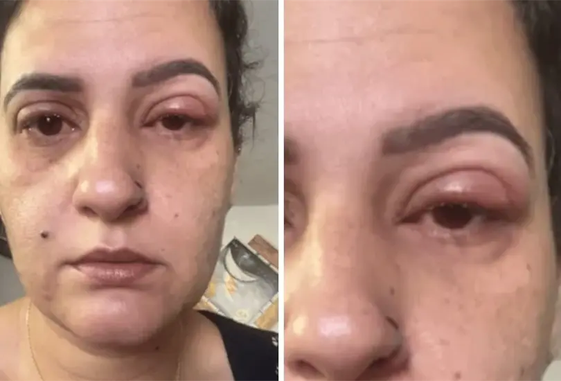 Afortunadamente, la mujer no tuvo problemas con su visi&oacute;n Cr&eacute;ditos: Especial 