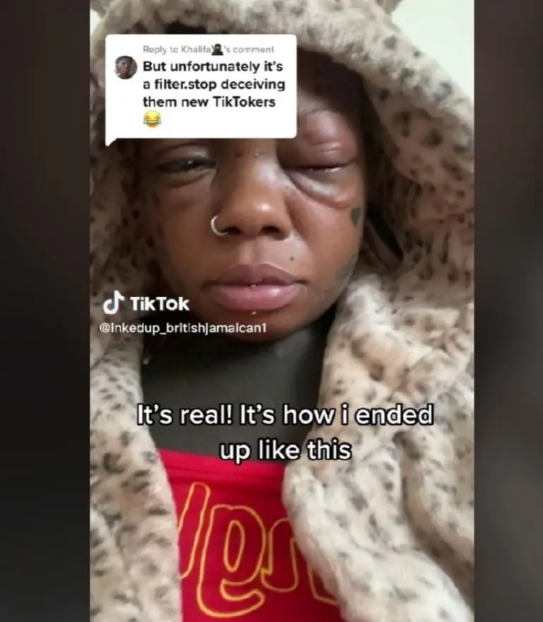 Complicaciones por tatuarse los ojos (TikTok)