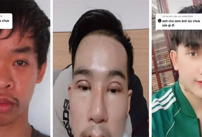 Al joven de 27 años no lo reconocían ni en su casa tras las operaciones Al joven de 27 años no lo reconocían ni en su casa tras las operaciones