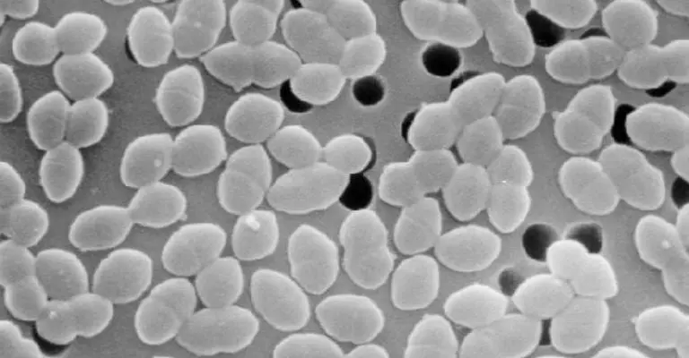 Los enterococos pueden causar diversas infecciones. Foto: Especial