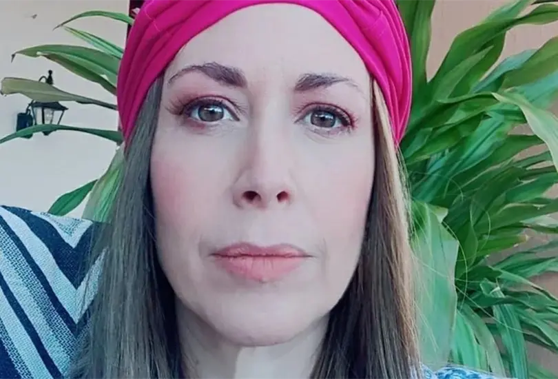 Marta Guzm&aacute;n se qued&oacute; sin cabello tras someterse a quimioterapias. 