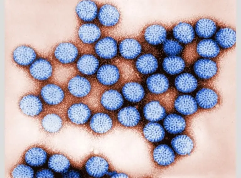 El rotavirus es un virus muy contagioso que causa diarrea. FOTO: Pixabay