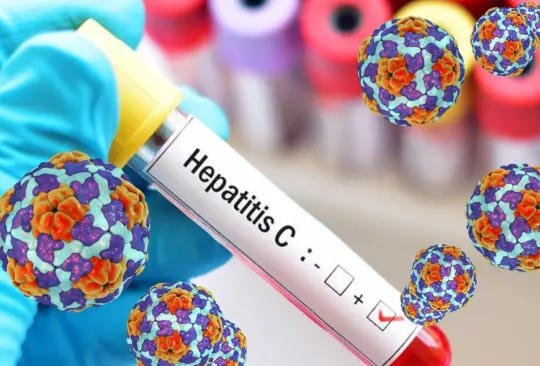 La OMS emitió una alerta epidemiológica por el aumento de casos de la hepatitis aguda infantil de origen desconocido, la cual ya ha registrado casos en más de 20 países del mundo, entre ellos México