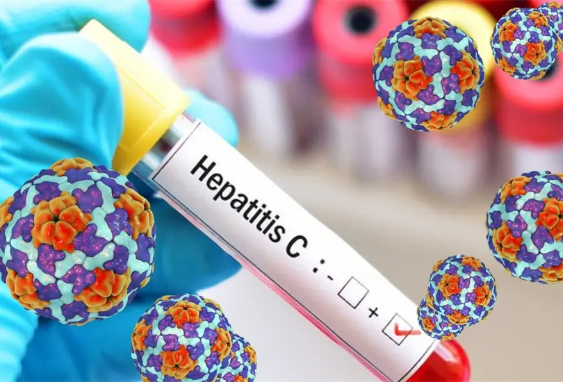 La OMS emiti&oacute; una alerta epidemiol&oacute;gica por el aumento de casos de la hepatitis aguda infantil de origen desconocido, la cual ya ha registrado casos en m&aacute;s de 20 pa&iacute;ses del mundo, entre ellos M&eacute;xico