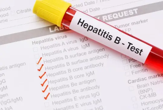 La hepatitis es una inflamación del hígado que puede ser mortal.