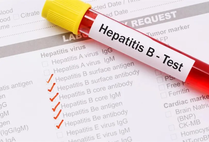 La hepatitis es una inflamaci&oacute;n del h&iacute;gado que puede ser mortal.