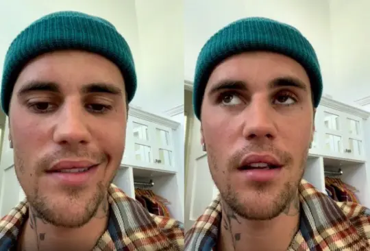 El cantante canadiense tuvo que cancelar su gira de conciertos debido a que sufrió una parálisis facial en la mitad del rostro
