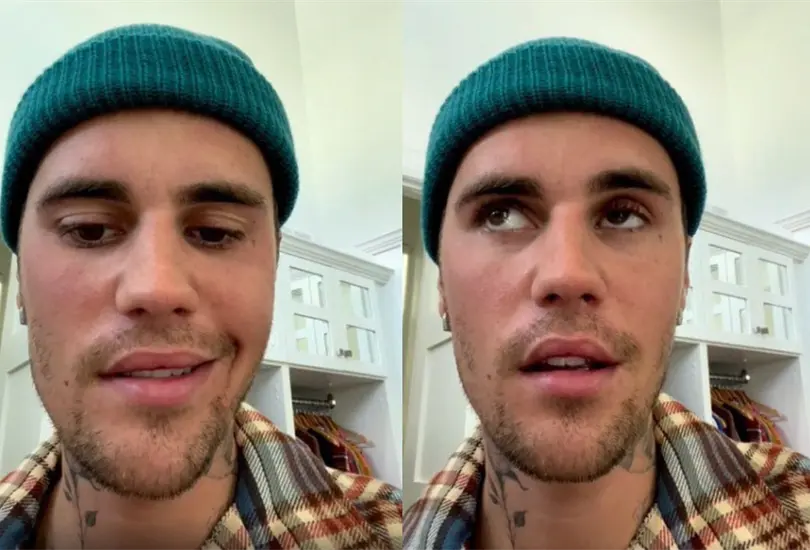 El cantante canadiense tuvo que cancelar su gira de conciertos debido a que sufrió una parálisis facial en la mitad del rostro El cantante canadiense tuvo que cancelar su gira de conciertos debido a que sufrió una parálisis facial en la mitad del rostro
