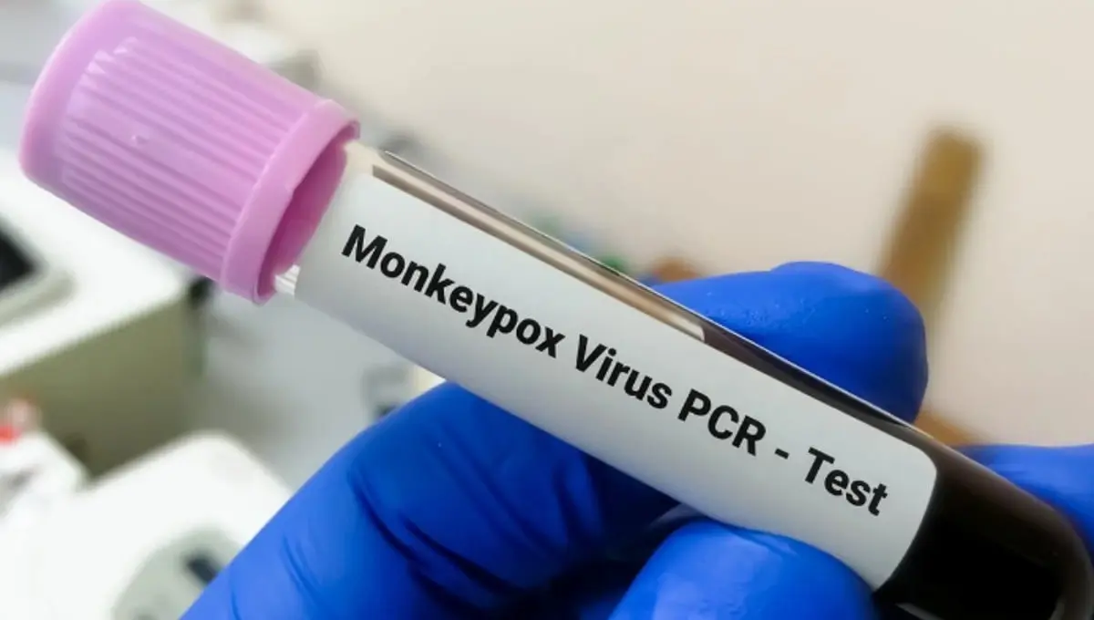 Aumentan casos de Mpox en México Especial