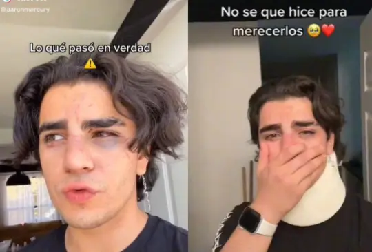 Golpean a influencer por botella de 10 mil pesos en un antro de Querétaro