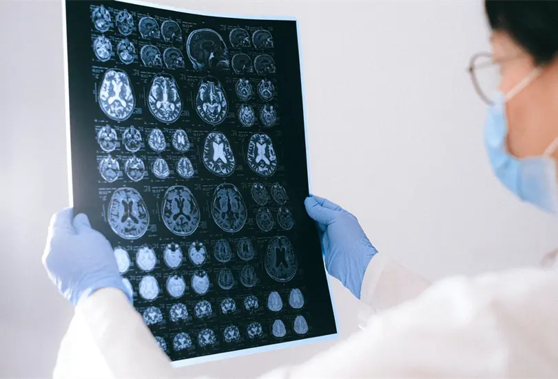 Algunas personas que se recuperaron de coronavirus han presentado p&eacute;rdida de memoria o confusi&oacute;n, secuelas que han sido calificadas como niebla mental del COVID-19.