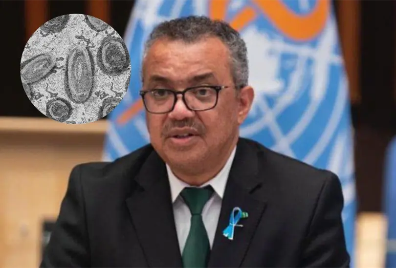 La OMS se&ntilde;al&oacute; que actualmente hay m&aacute;s de 16 mil casos de viruela s&iacute;mica en m&aacute;s de 70 pa&iacute;ses, y se han registrado cinco muertes