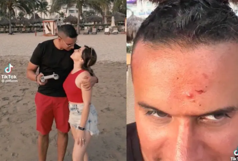 El hombre intent&oacute; grabar un video con un dron mientras besaba a su novia en la plata, pero presion&oacute; un bot&oacute;n mal y el artefacto se estrell&oacute; contra su frente