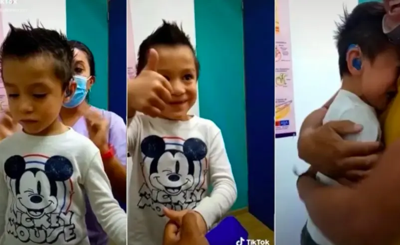 Ni&ntilde;o con problemas auditivos escucha por primera vez a sus padres y su tierna reacci&oacute;n se hace viral